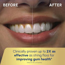 Waterpik Aquarius Water Flosser For Teeth Cleaning, Gums, Braces, Dental Care, Electric Power With 10 Settings, 7 Tips For Multiple Users And Needs, ADA Accepted, White WP-660, Packaging May Vary